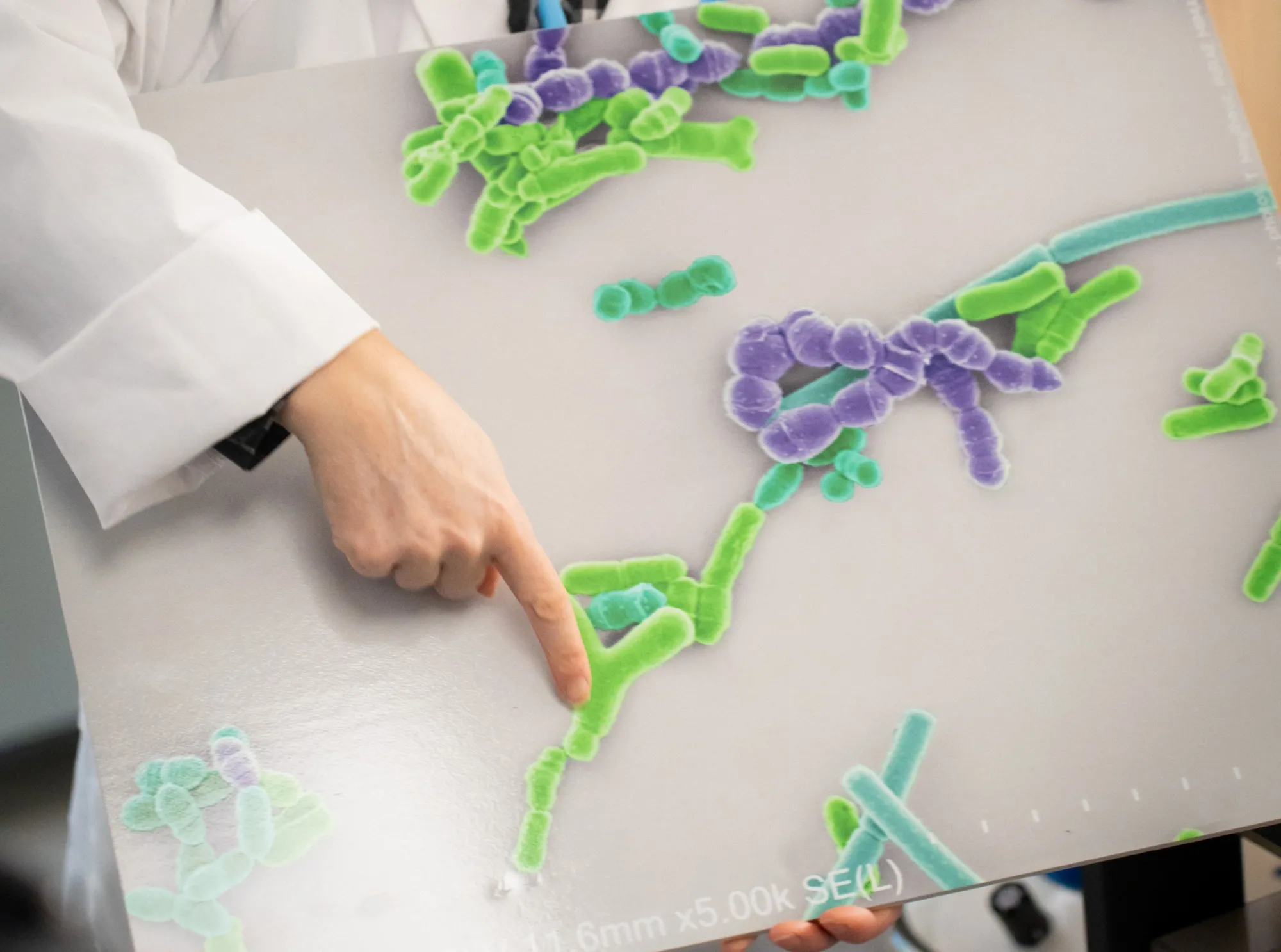 A Bifidobacterium strain, shaped like a Y, found in yogurt.
