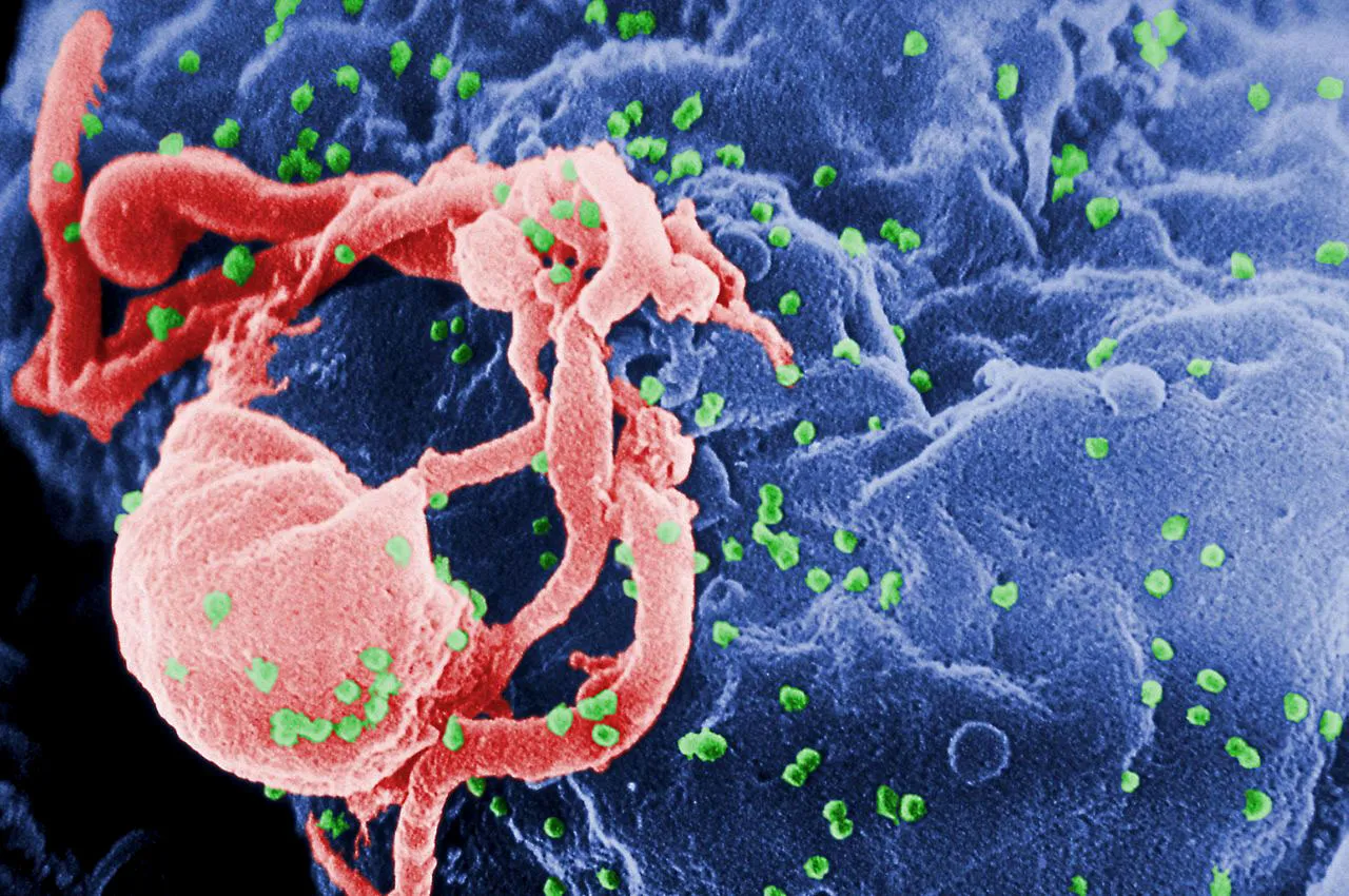 HIV-1 budding (in green) from a cultured lymphocyte.
