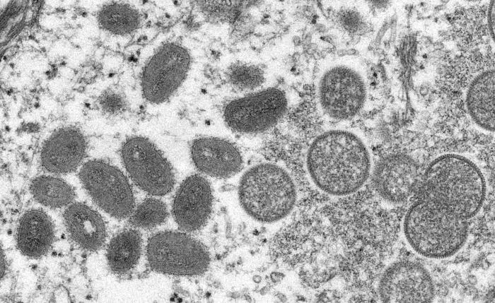 An electron microscopic image depicting a monkeypox virion.