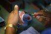 Need For Dentures Declines, As Dental Health In US Improves