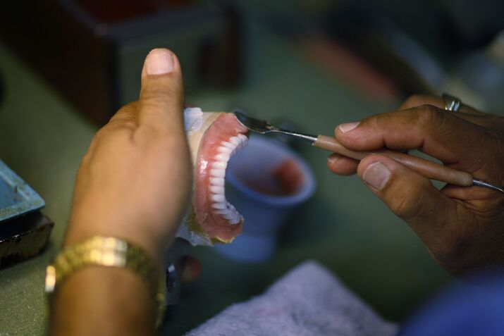 Need For Dentures Declines, As Dental Health In US Improves
