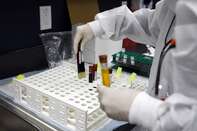 relates to India Has New Record; Global Cases Near 30 Million: Virus Update