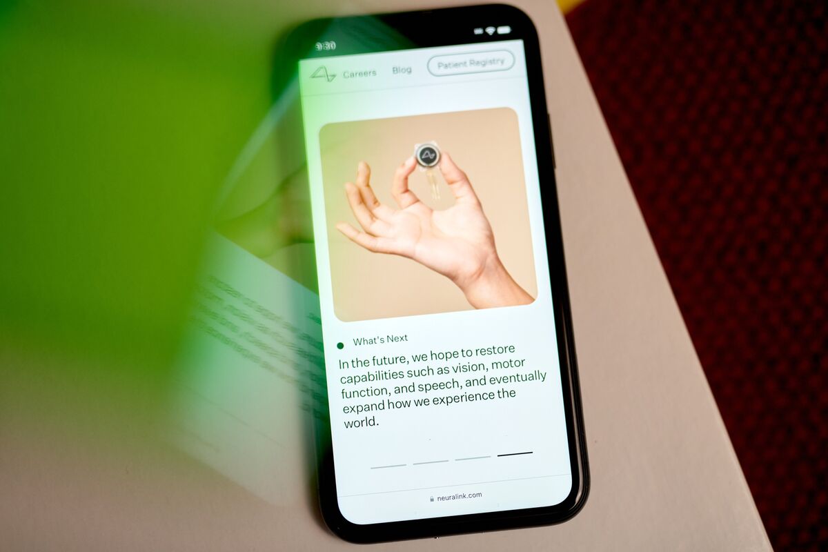 Neuralink Begins UK Brain Implant Trials