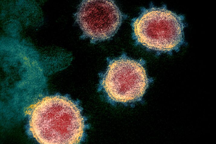 Covid-19 Survivors Who Test Positive Again Aren't Infectious: Study