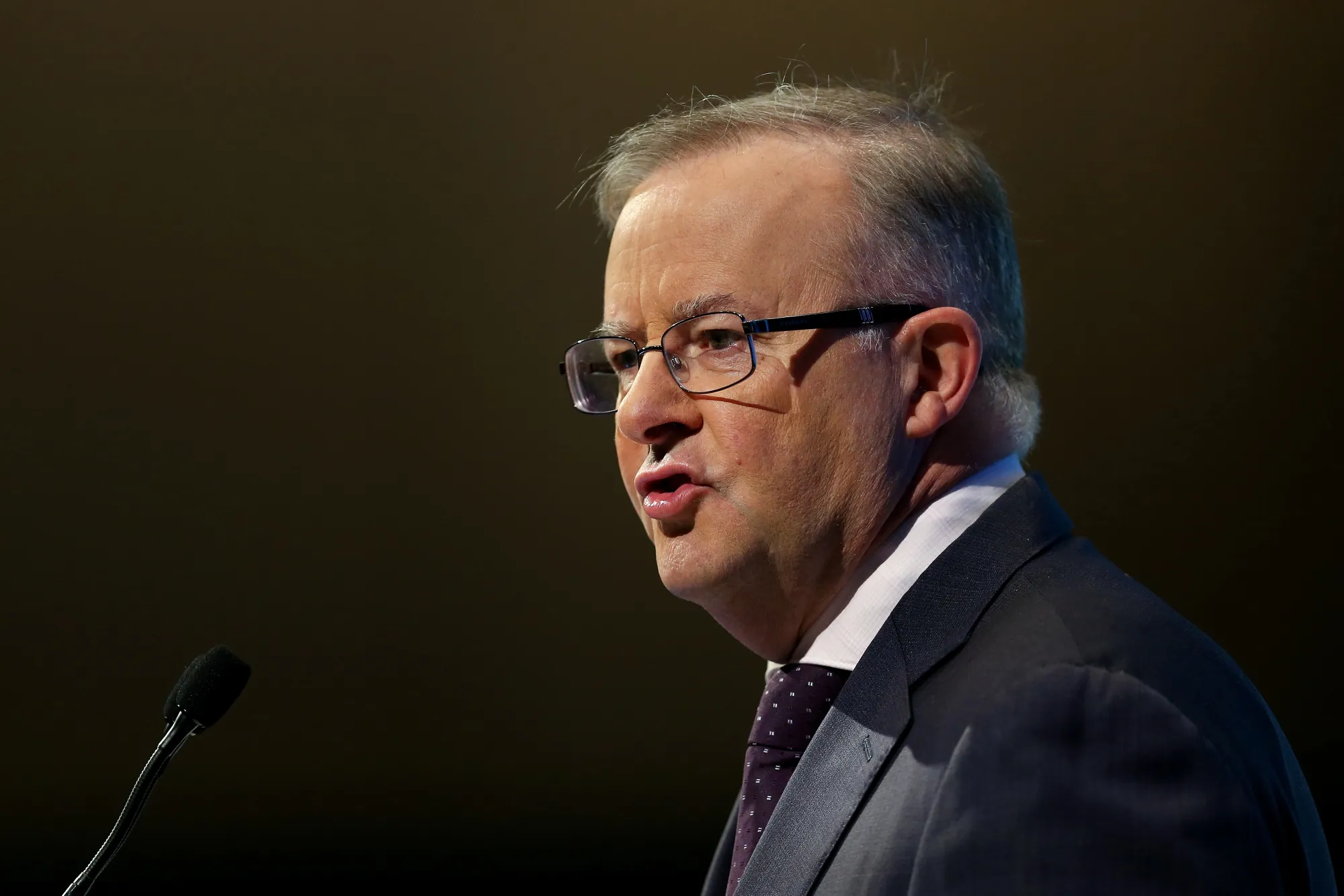 Anthony Albanese in March.