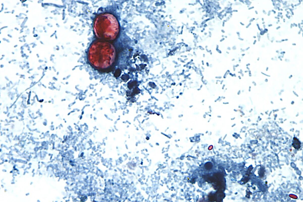 Lettuce Linked to Parasite Is Just the Tip of the Iceberg