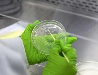 relates to Deadly Superbugs Win as Wall Street Flees Makers of Antibiotics