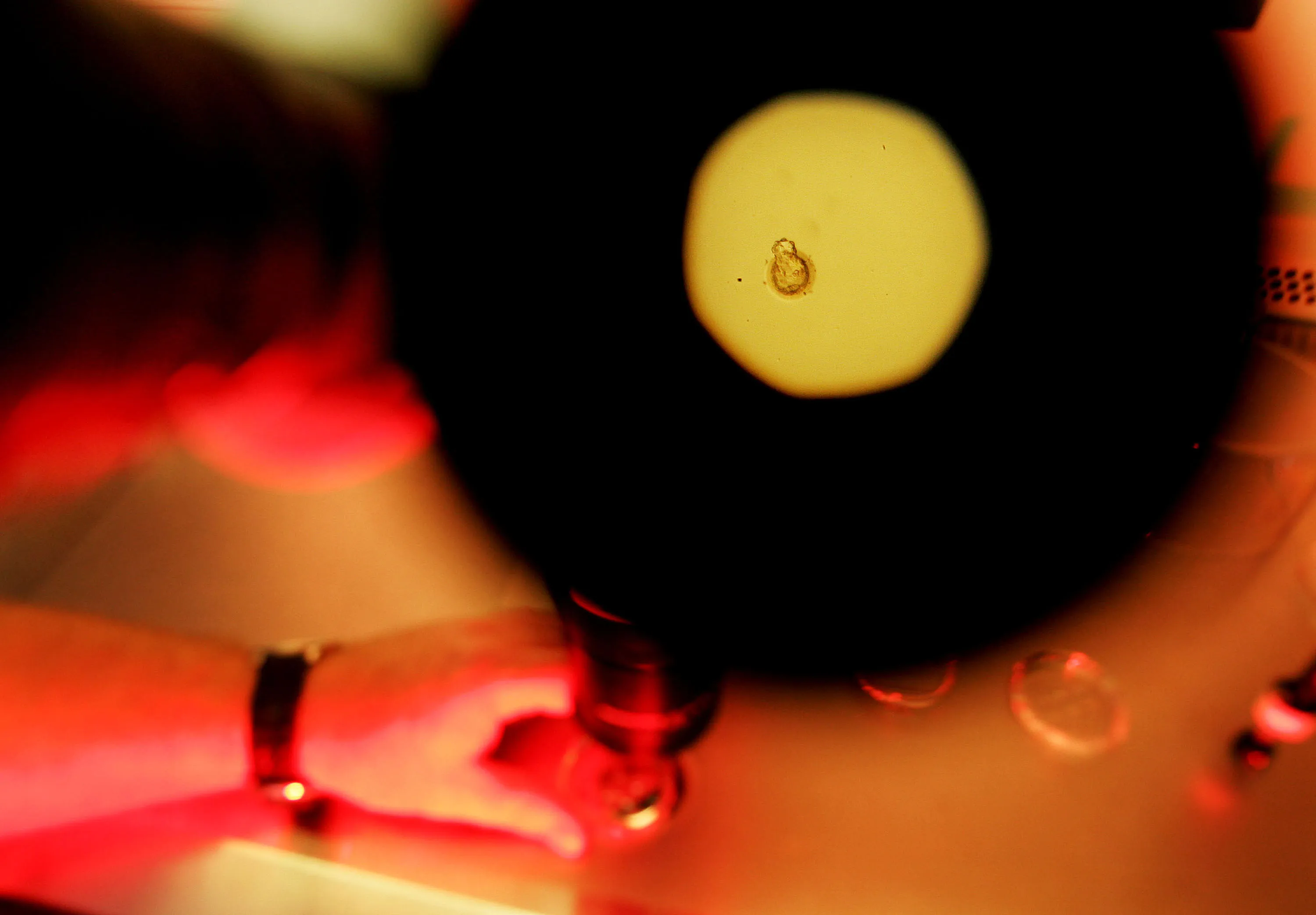 A human embryo under a microscope.
