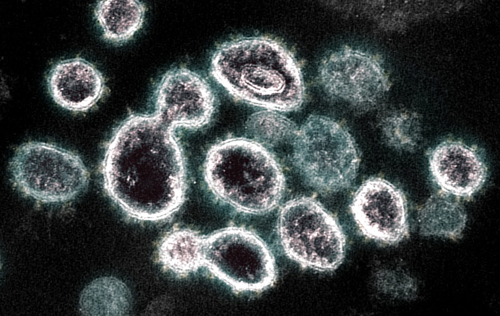 This transmission electron microscope image shows SARS-CoV-2, the virus that causes Covid-19, isolated from a patient.&nbsp;