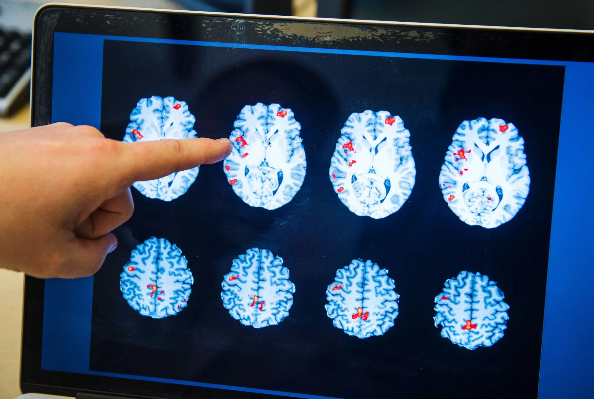 A person points to a brain scan showing brain activity. See how scientists are researching new ways to control pain on The Future with Hannah Fry.&nbsp;