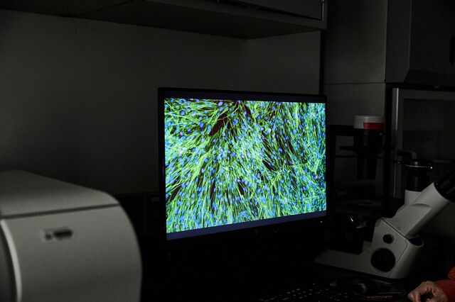 A screen in Dr. Yousin Suh’s lab of genetically modified cells that are common in the ovary