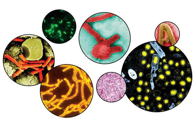 The Sky-High Price of Sniffing Out Anthrax