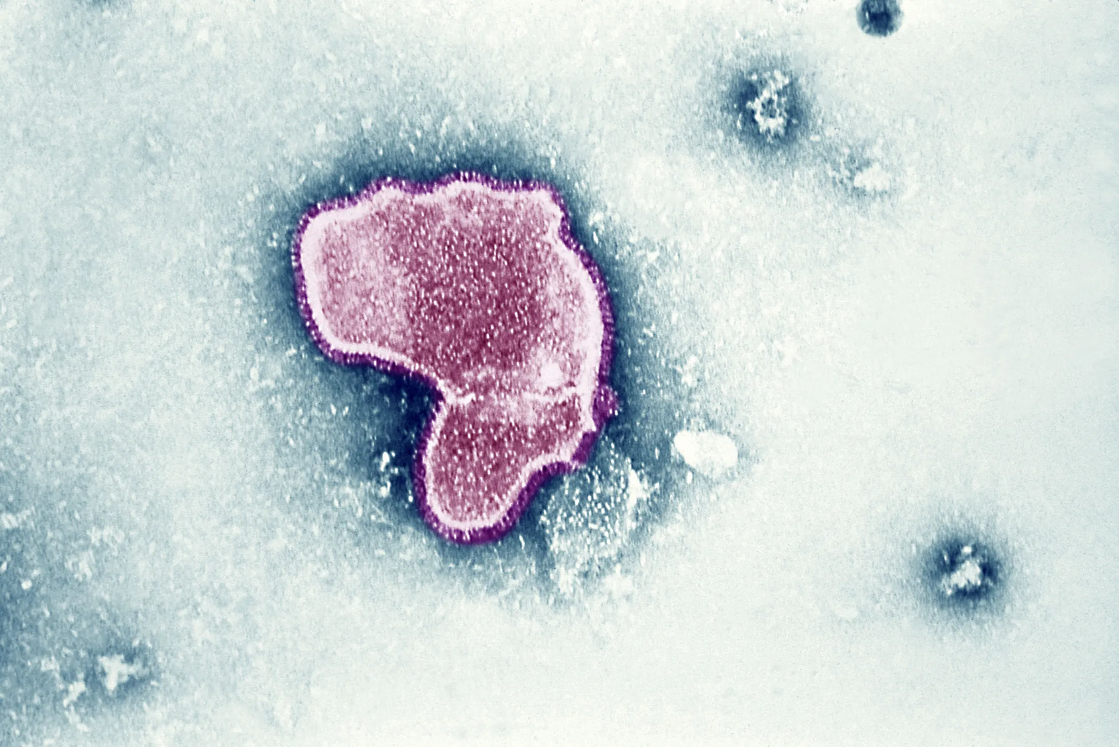 An Electron Micrograph shows the morphologic traits of the Respiratory Syncytial Virus (Rsv).