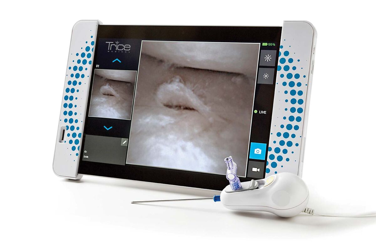 Needle Machine Camera This Needle Cam Can Diagnose Joint Injuries Without an MRI - Bloomberg