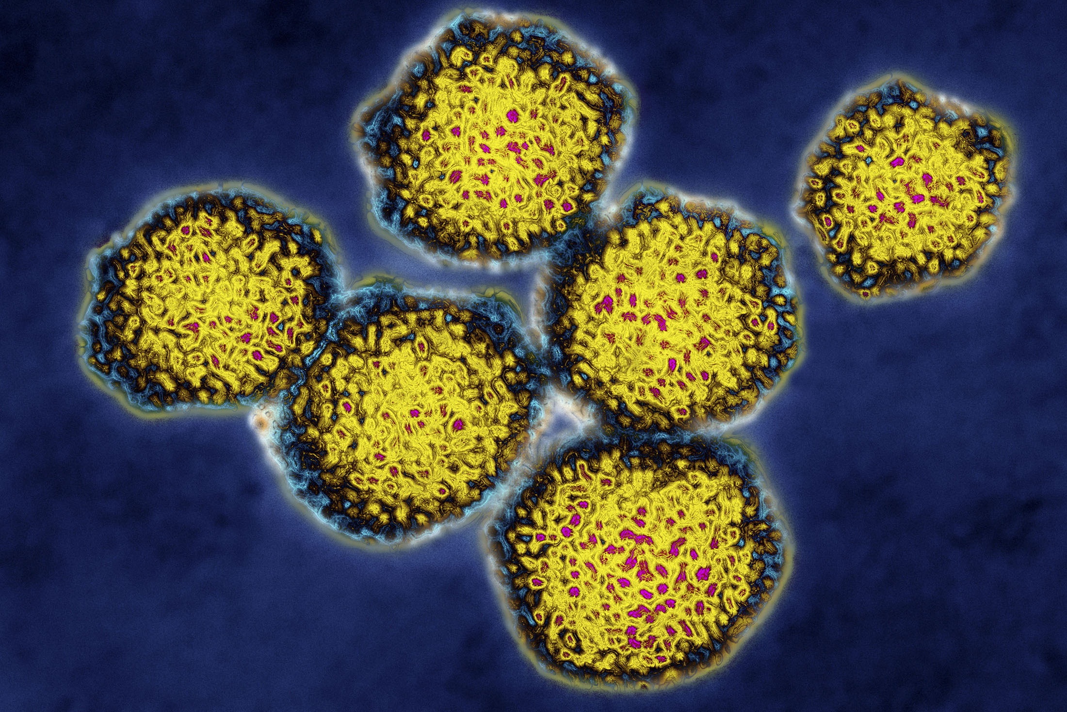 Hepatitis C Virus
