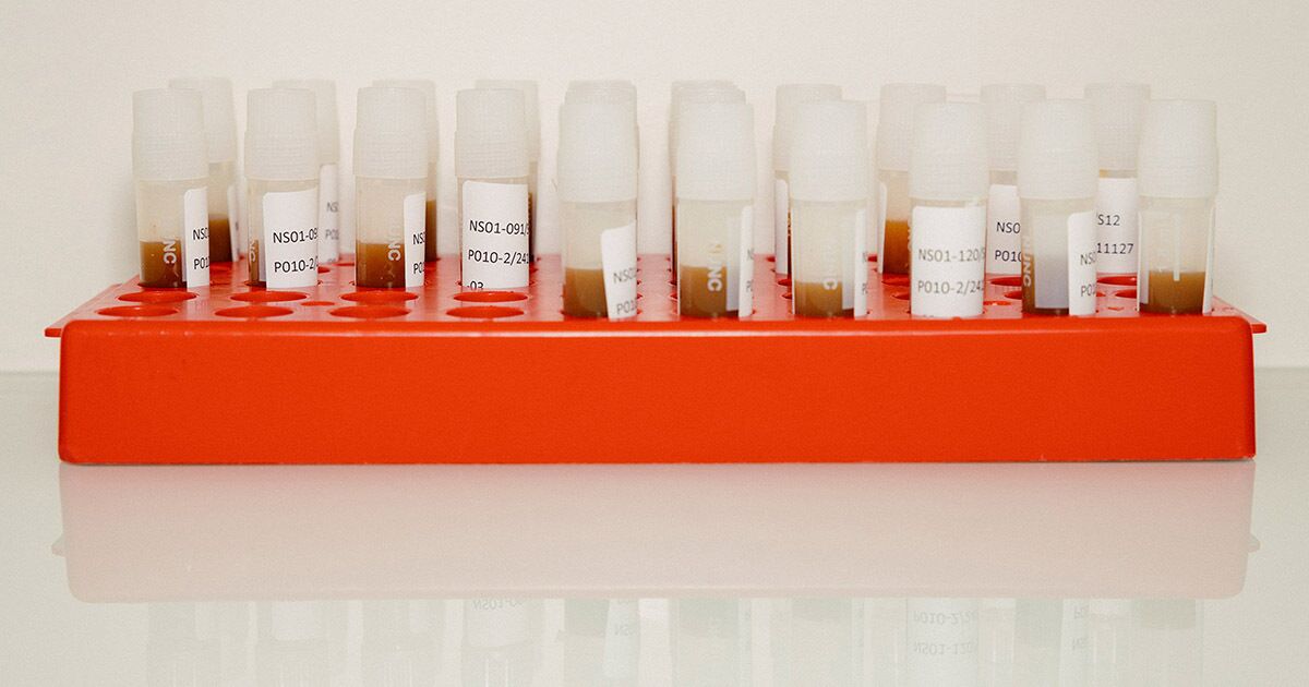 The Quest to Turn Human Waste Into Medicine