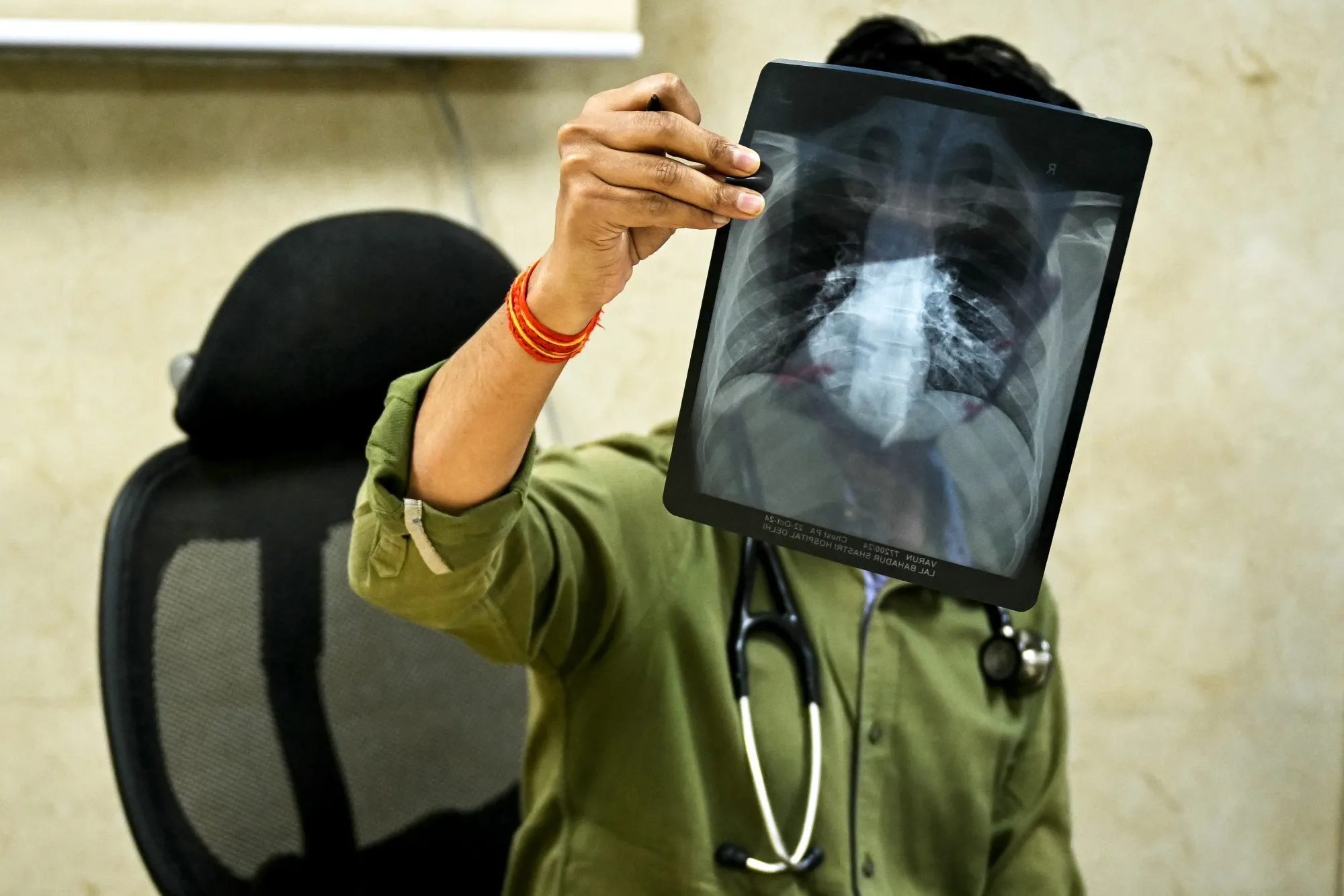 Indian AI Medical Imaging Firms Read Scans Faster to Help Radiologist  Shortage - Bloomberg
