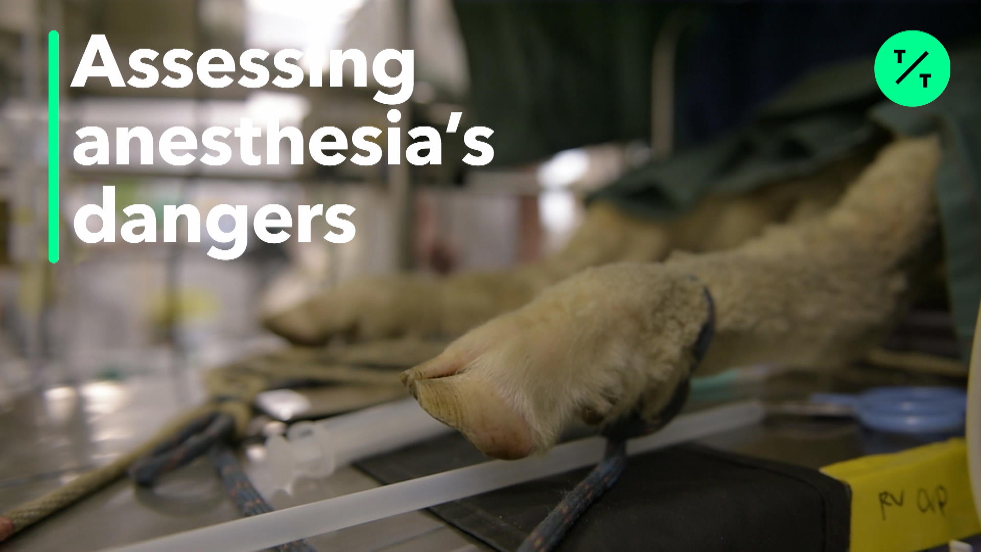 Watch Anesthesia Can be Dangerous Bloomberg