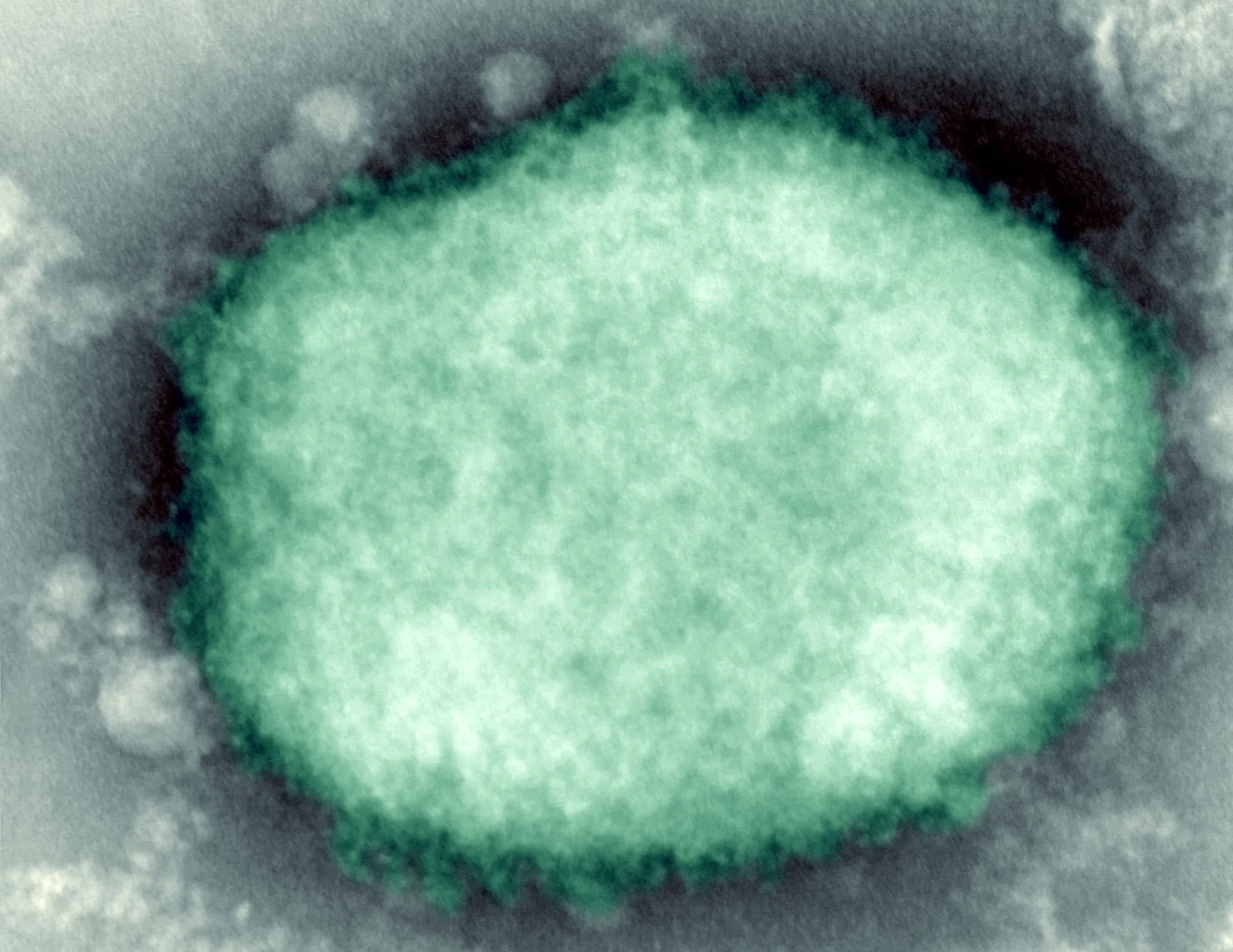 Indonesia Confirms First Case of Monkeypox in Local Who Traveled ...