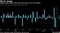 Hedge funds suffer amid low-vol's best run in 28 months