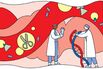 Putting an End to Heart Attacks by Editing Human DNA