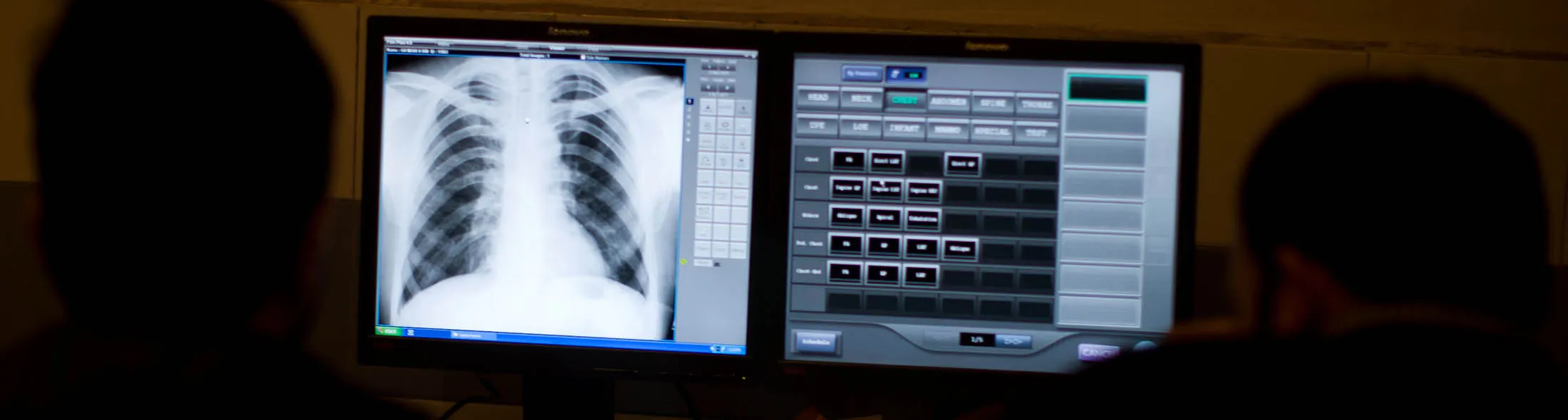 1483692379_lung xray large lede