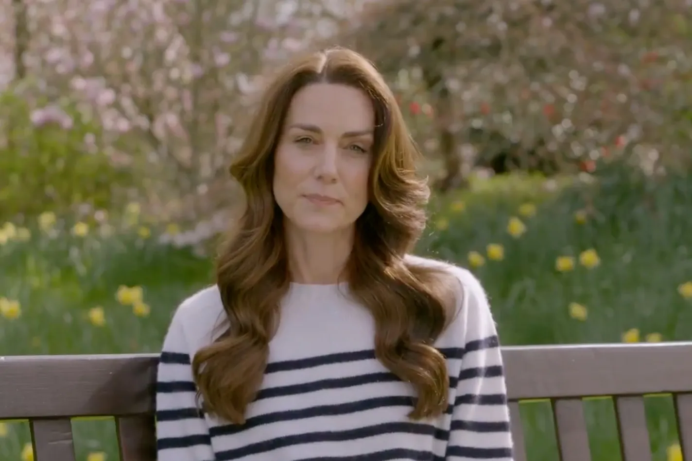 Kate Middleton Isn't Only Celebrity to Keep Cancer Battle Secret - Bloomberg