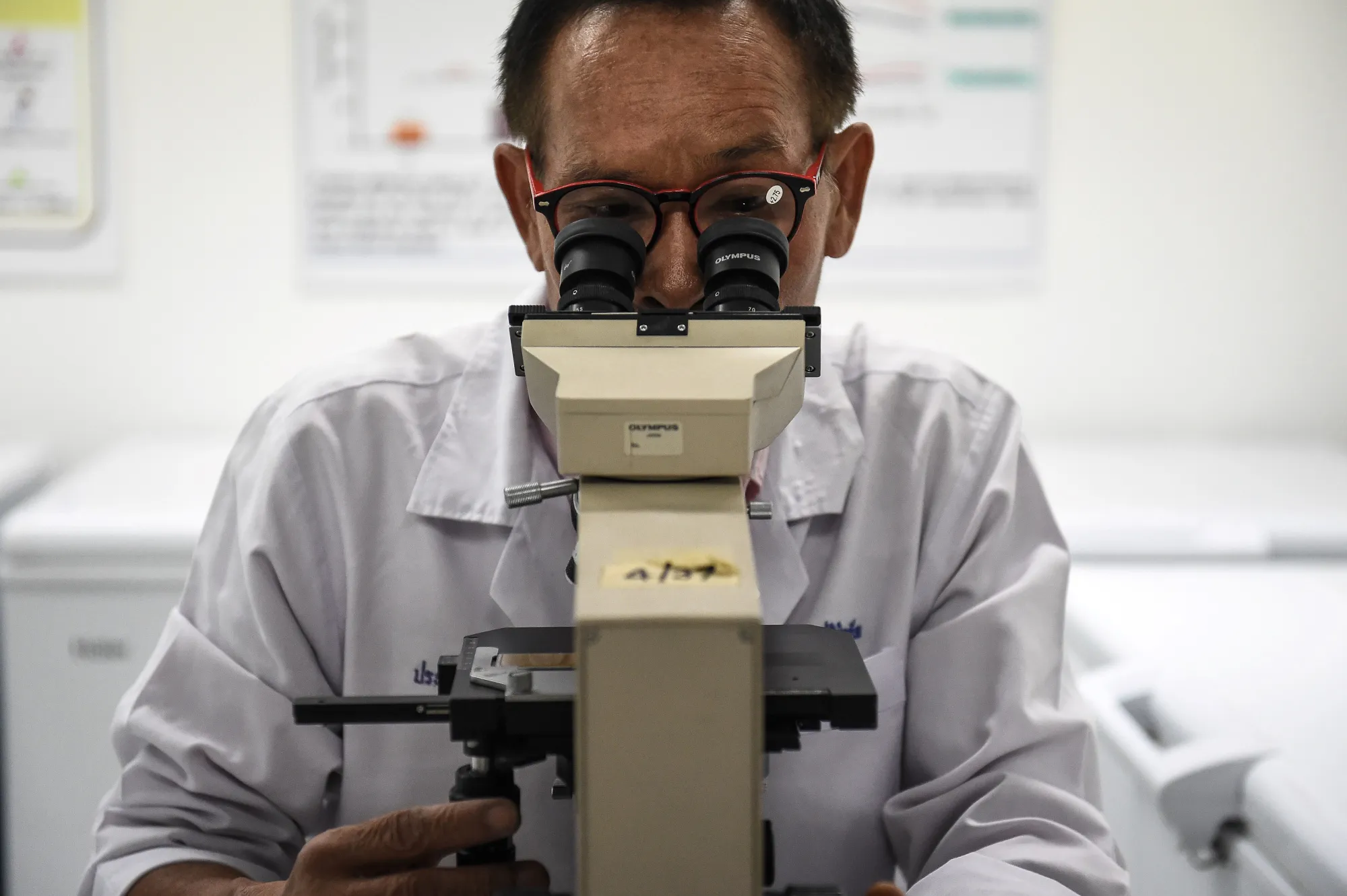 A researcher looks for a parasite that causes liver cancer in a urine sample at Khon Kaen University in Thailand.