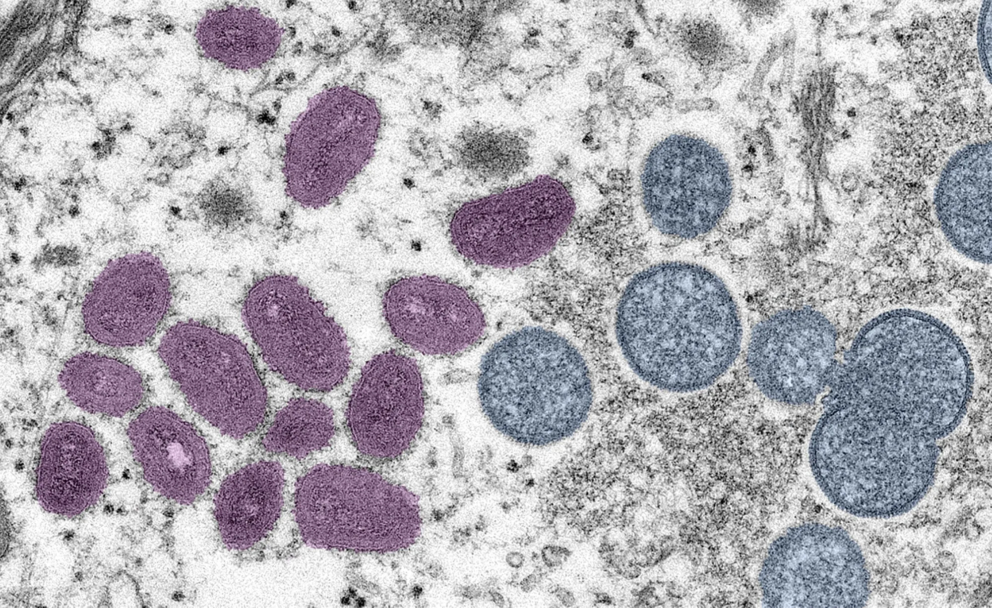 Digitally-colorized electron microscopic&nbsp;image depicting a monkeypox virion.