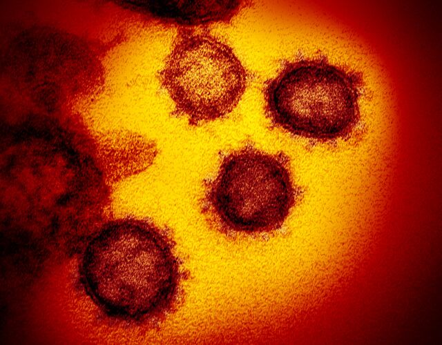 A microscope image of the SARS-CoV-2 virus