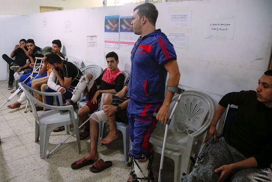 In Gaza, Maimed Legs Are a Badge of Honor—Until Reality Sets In