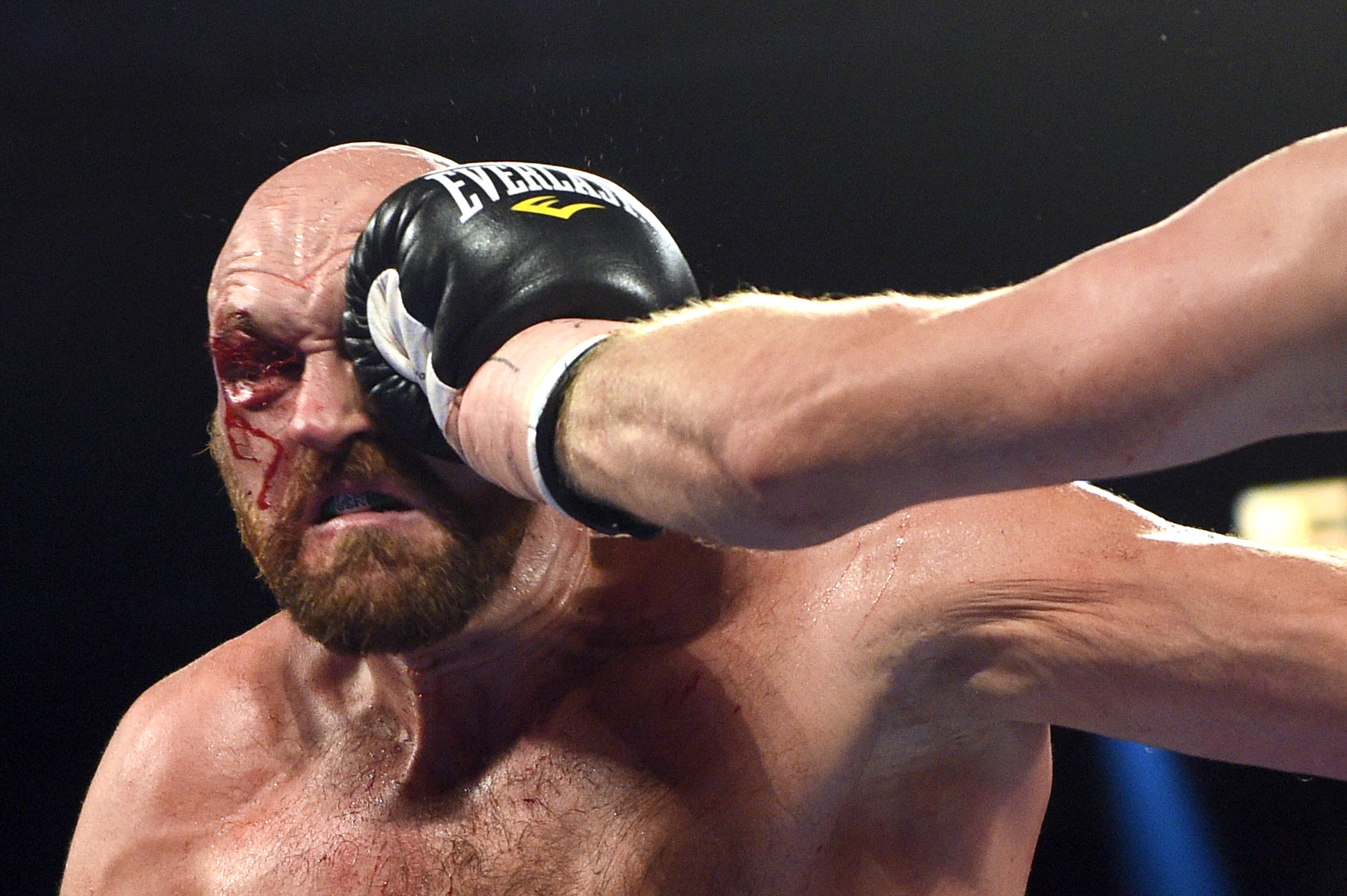 Fury Overcomes Bloody Cut Over Eye to Beat Wallin