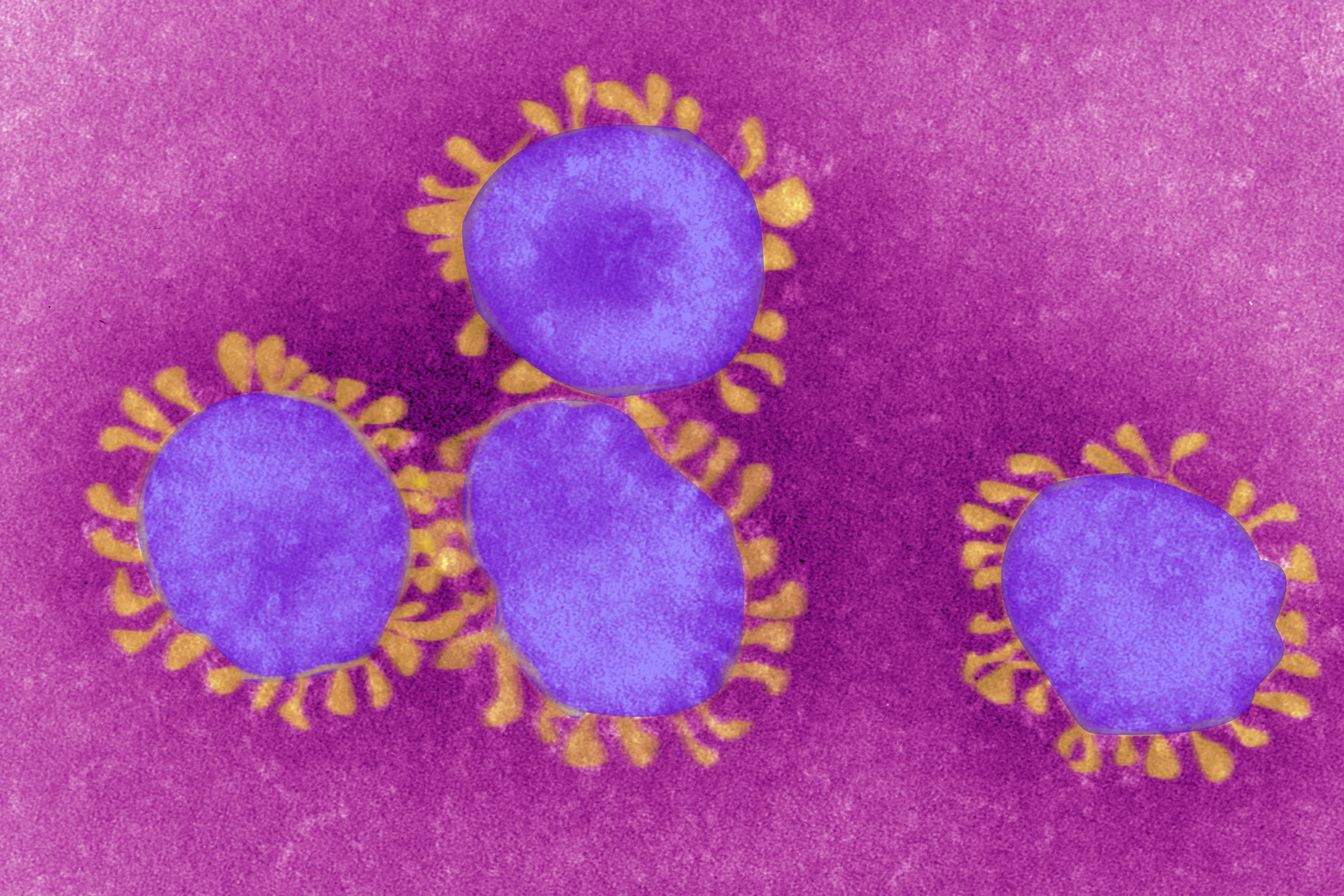 A coronavirus.