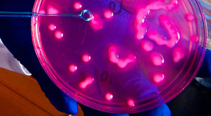 Carbapenem-resistant enterobacteriaceae, also known as CRE.
