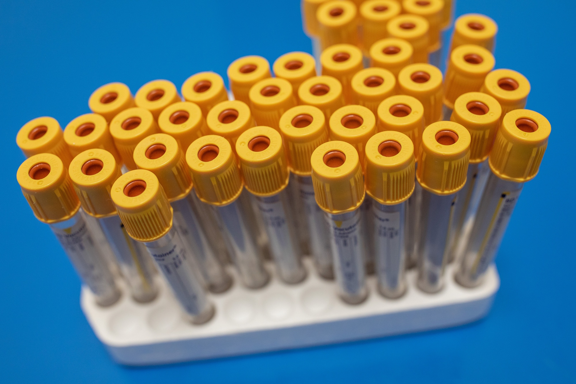 Empty test tubes&nbsp;await&nbsp;blood samples at an antibody testing program&nbsp;in Birmingham, England.