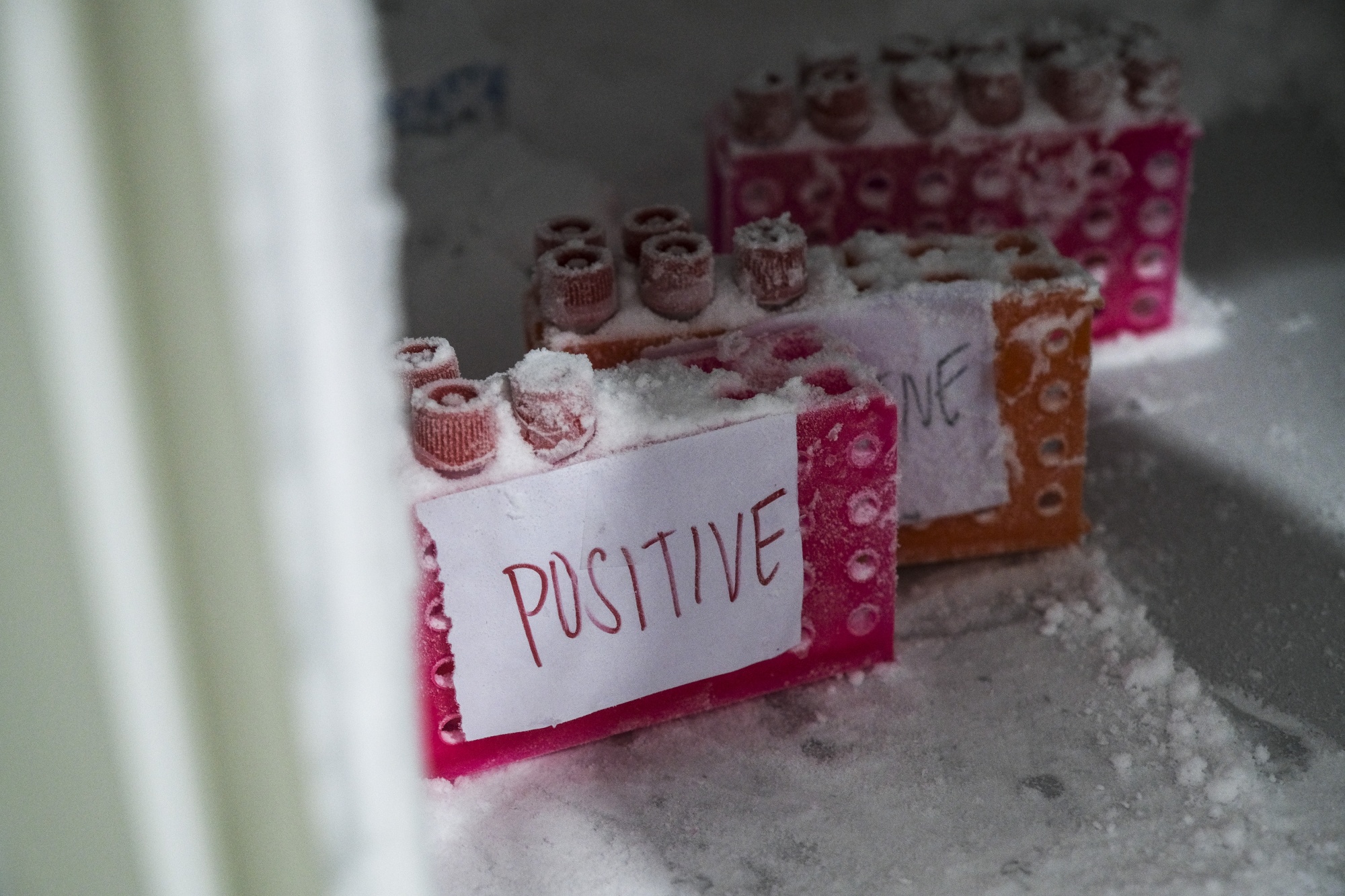 Here Are Some of the Factors Linked to Long Covid Bloomberg