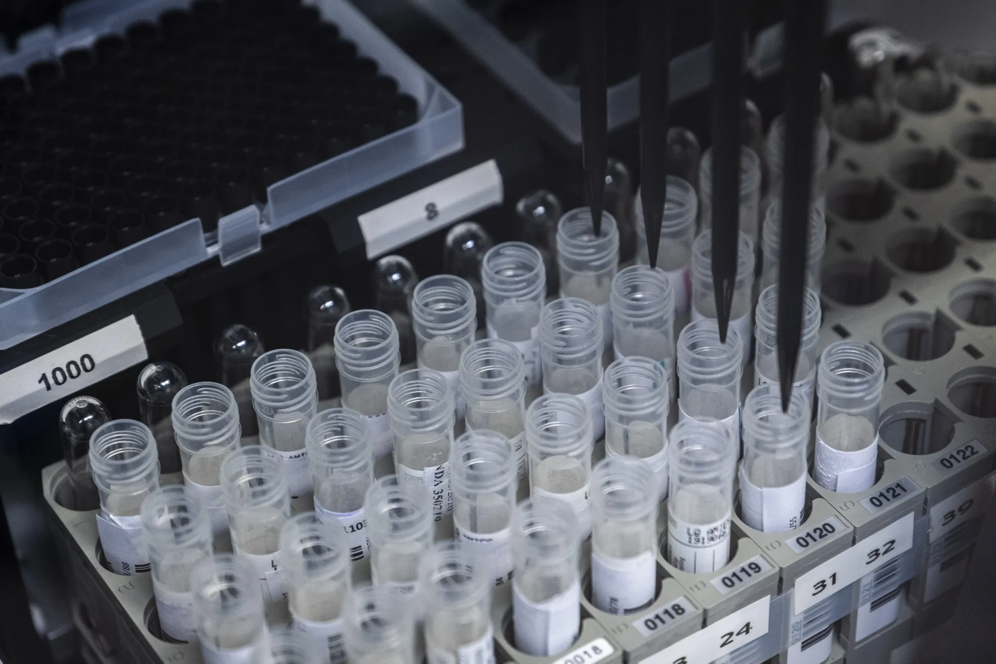 Covid-19 Swab Testing at France's LBM LxBio Laboratory