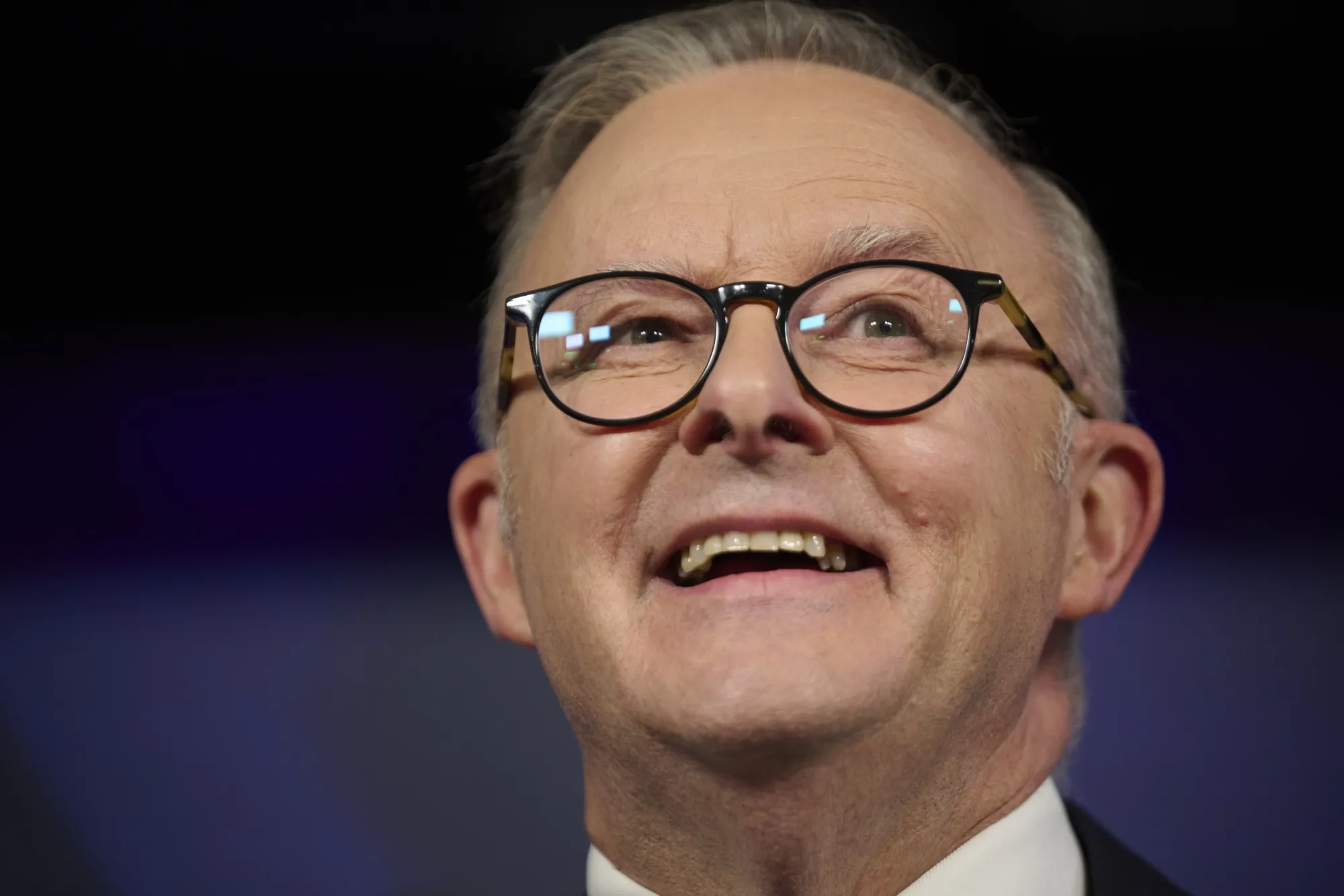 Anthony Albanese
