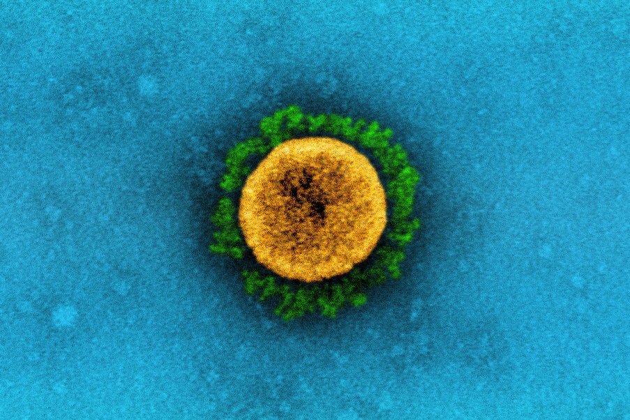 It’s Taken Scientists Two Years to Rename Airborne Viruses After Covid ...