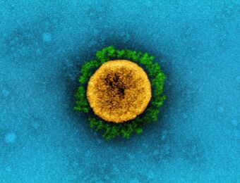 relates to It’s Taken Scientists Two Years to Rename Airborne Viruses After Covid Mistakes