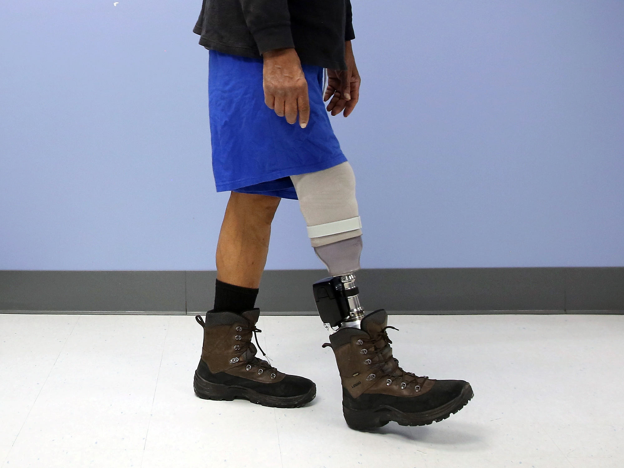 VA Hospital Provides Amputees With Prosthetics And Adaptive Sports