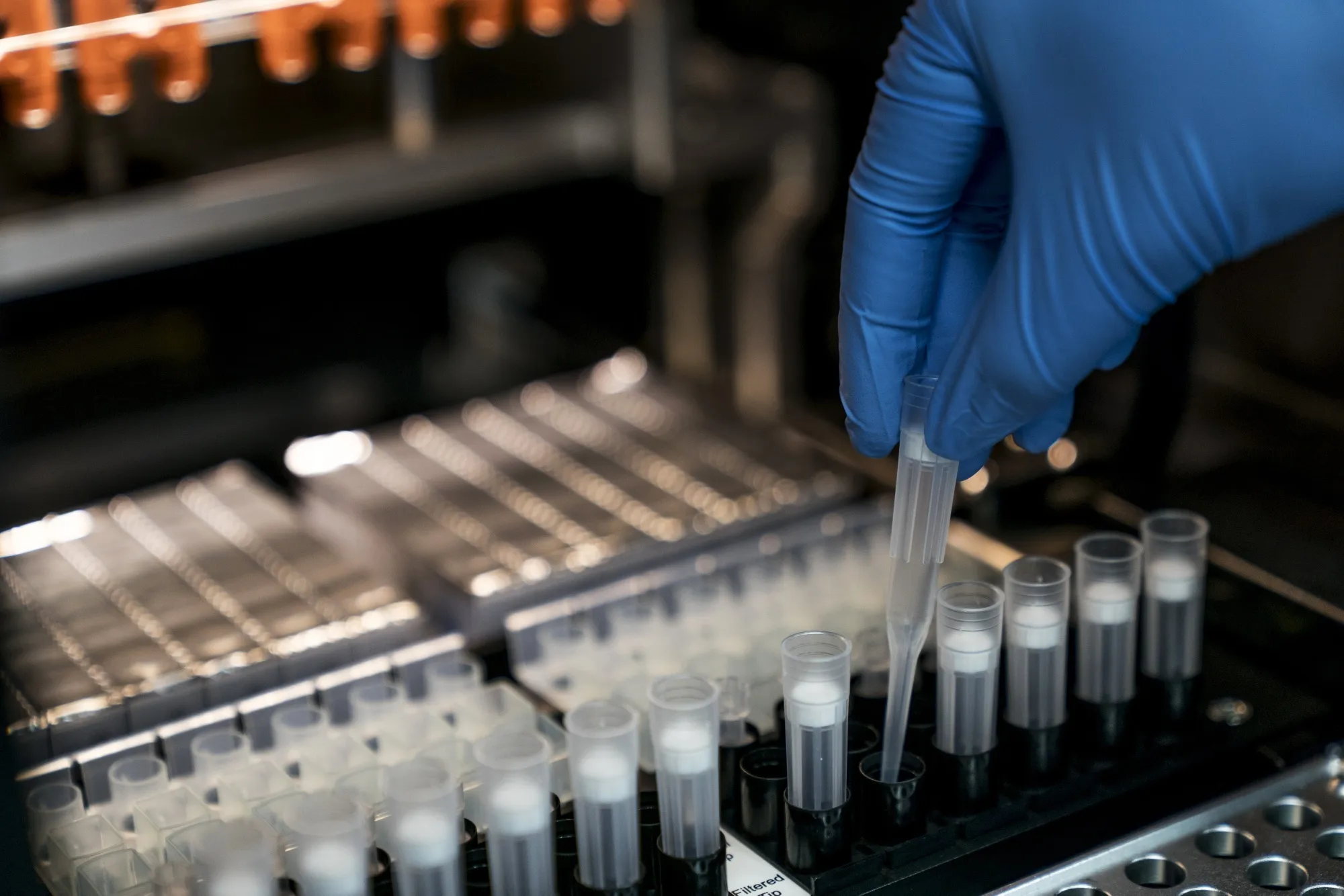 A technician handles a DNA sample at a Prenetics Inc. laboratory in Hong Kong, China, on Friday, Jan. 26, 2018.&nbsp;
