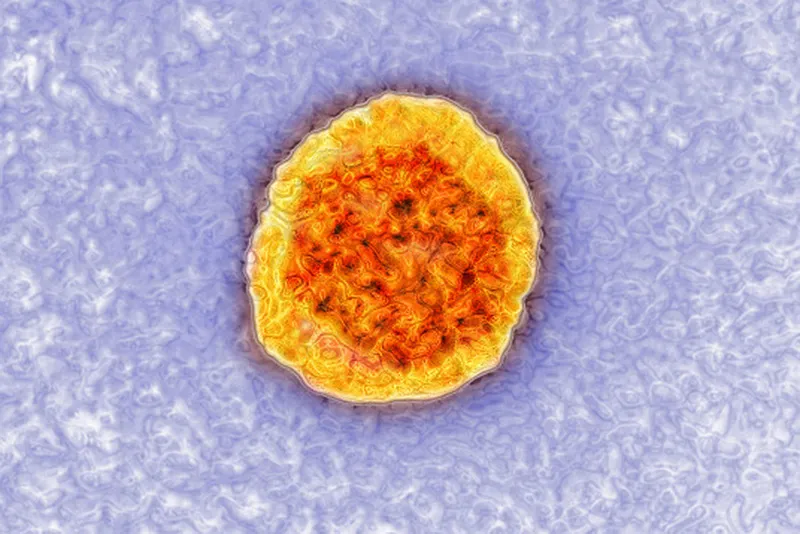 Hepatitis C virus (HCV). HCV causes a hepatitis that is transmitted through the blood stream (intraveinous drugs, professional exposure and nosocomial transmission). During chronic hepatitis C, cirrhosis can develop 10-20 years later, with a risk of hepatic cancer. Image produced using high-dynamic-range imaging (HDRI) from an image taken with transmission electron microscopy. Viral diameter around 22 nm.
