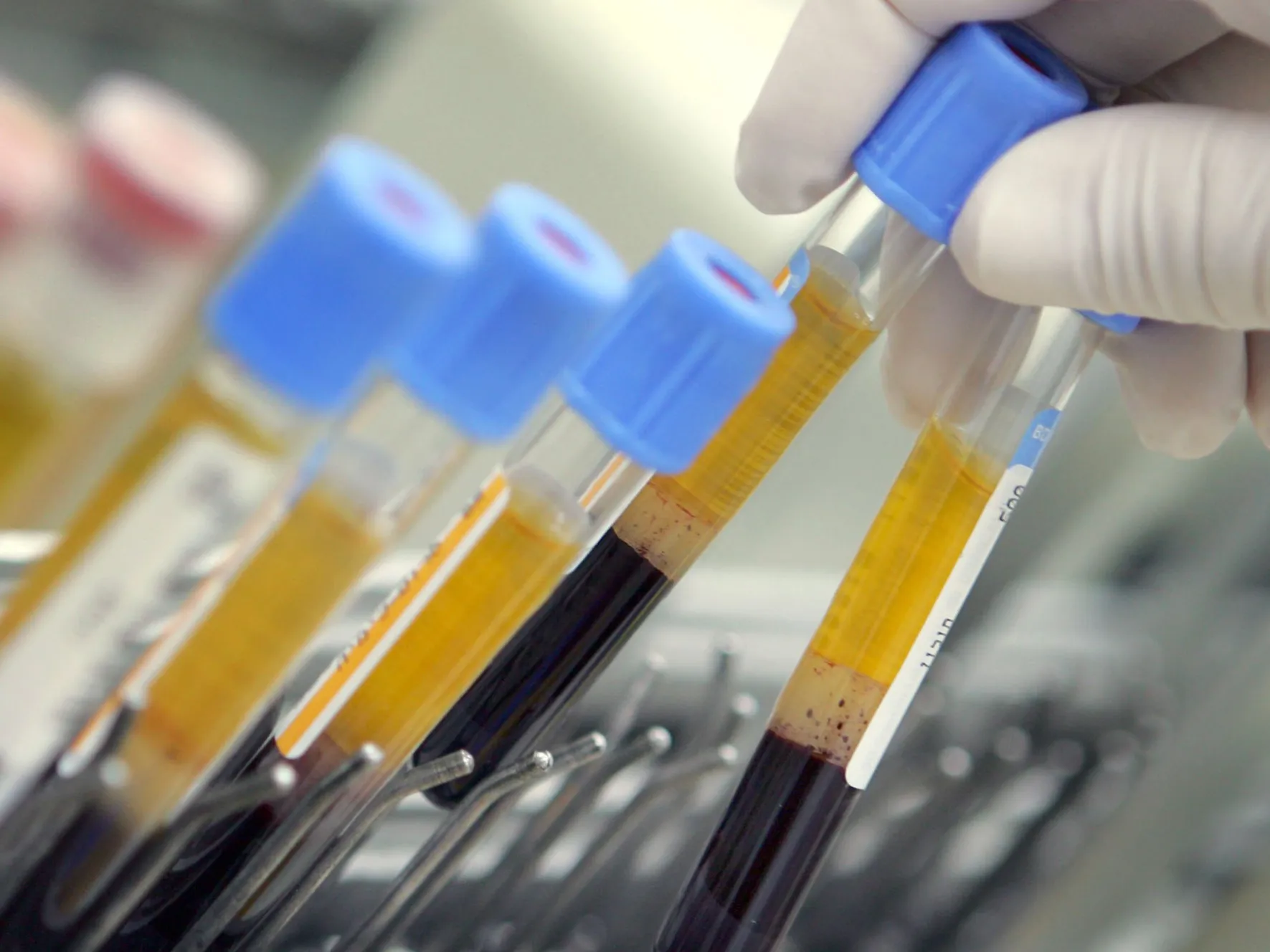 Israeli Laboratory Leads Western World In Blood Testing