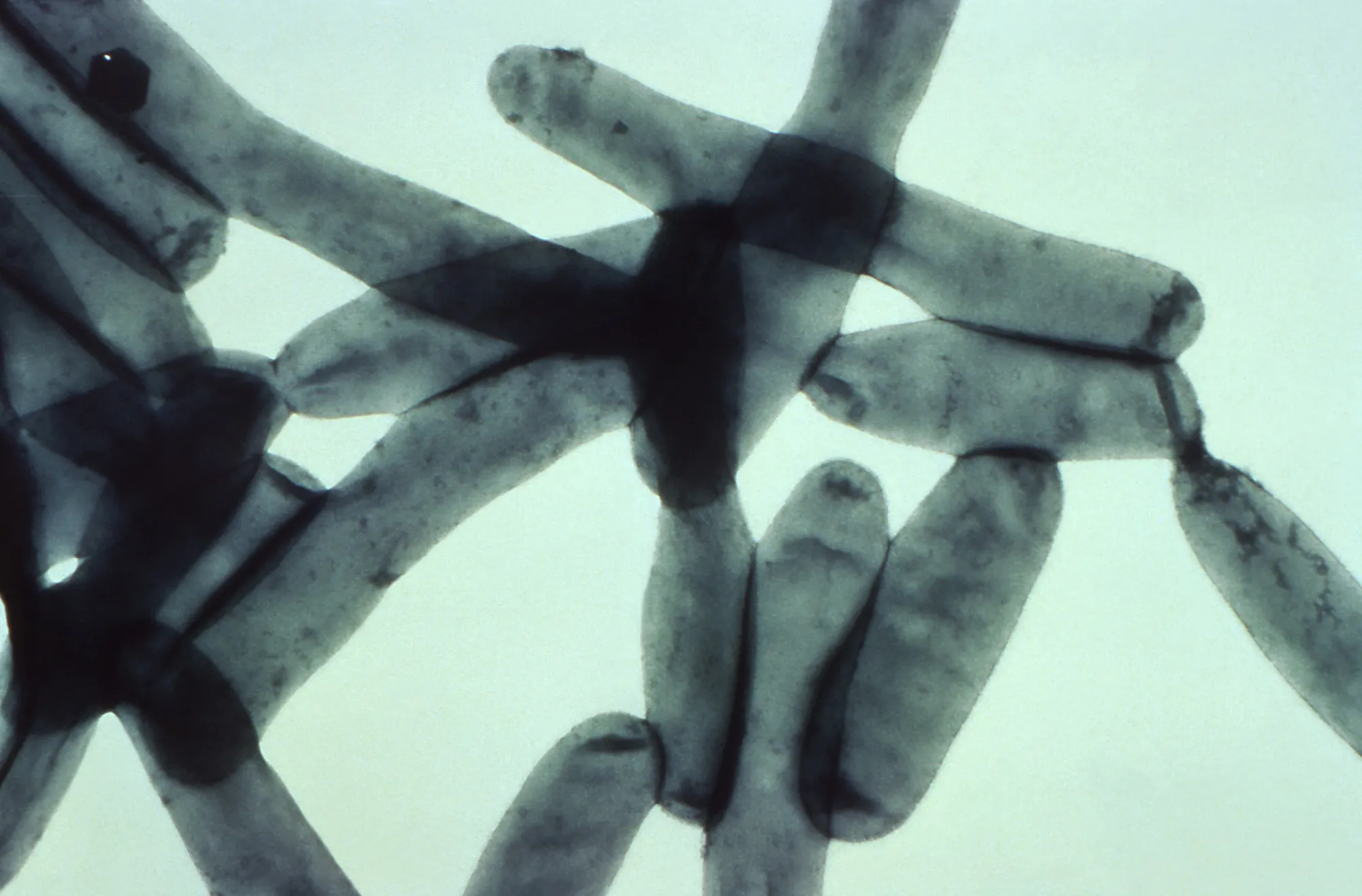 Under a magnification Legionella pneumophila bacteria that leads to&nbsp;Legionnaires' disease.
