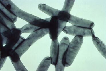 Legionella pneumophila bacteria