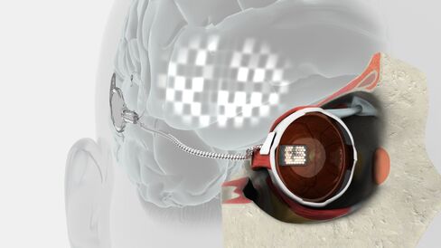 Blind Poised to See in Bionic Eye Drive for 285 Million