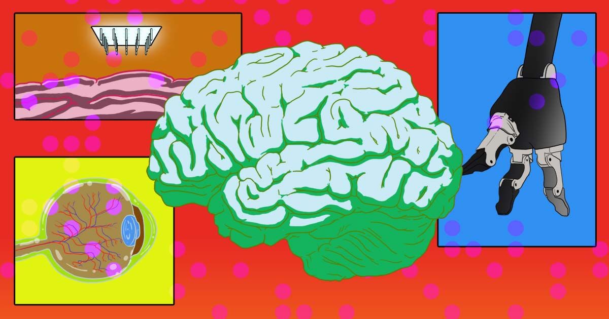bloomberg.com - Ike Swetlitz - Why Brain Implants Are More Than a Sci-Fi Fantasy