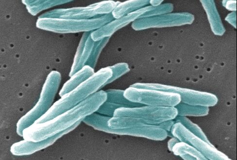 Stowaway Killer TB Travels Globe Fueling Screening Sales