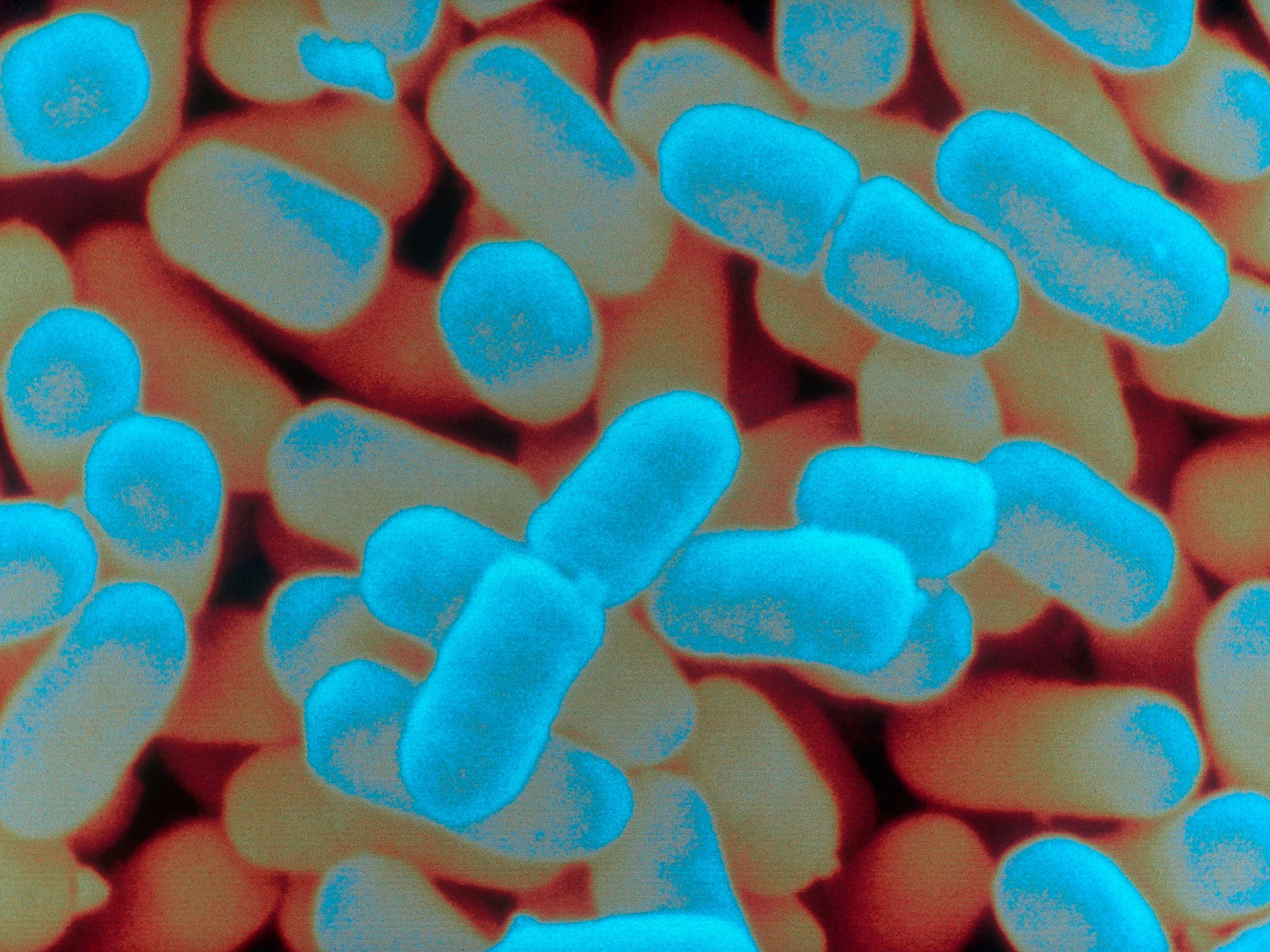 Enterobacteriaceae spp enterococcus spp. Шигелла Зонне. Дизентерийная палочка Зонне. Шигеллы Флекснера. Шигеллы микробиология.